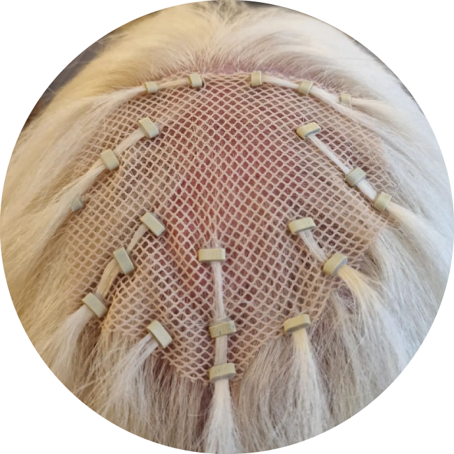 MESH INTEGRATION HAIR LOSS COURSES IN BERKSHIRE, UK