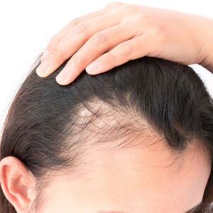 Fundamentals Of Hair Loss Course